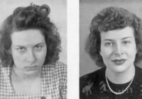 “Lobotomijas zelta laiki”: pacientu fotogrāfijas pirms un pēc
